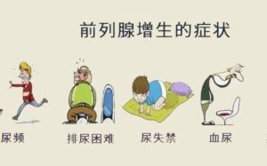 湖北中医还在哪里坐诊及前列腺增生伴慢性前列腺炎尿频尿急夜尿6次中药怎么治？